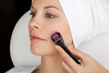 Trị sẹo lõm lâu năm ở mặt nhanh nhất - Thư Giản