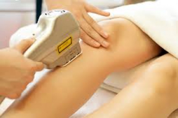 Triệt lông vĩnh viễn bảo hành bao lâu? - Thư Giản